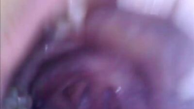 Câmara dentro da vagina