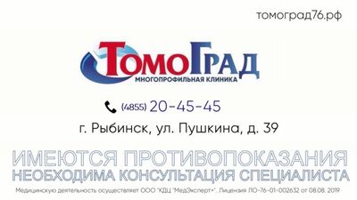 Vídeo de Tomograd Rybinsk (RM/TC/ecografia/consultas médicas)