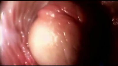 Porno-Video präsentiert: Penis in der Vagina. (Video mit einer am Penis befestigten Kamera im Inneren der Vagina), ab 18 Jahren: