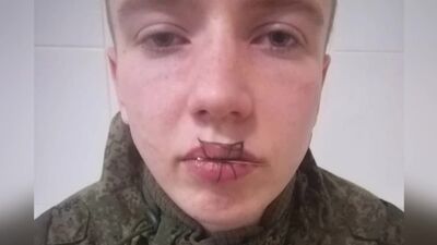 Dans la région de Tcheliabinsk, un soldat de la région de Sverdlovsk s'est cousu la bouche après une dispute avec une jeune fille
