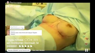 Доктор Едгар демонструє груди третього розміру