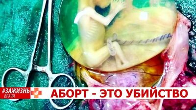 ¡EL ABORTO ES UN ASESINATO! Olga Viktorovna Lyashenko, médica obstetra-ginecóloga, centro de atención a la mujer n.º 4, Krasnodar