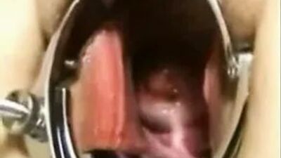 Elmer Wife - 2 Hands Anal Fist S Objects
