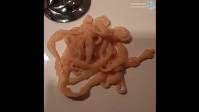 Стрічковий черв'як (Cestoda) з кишечника людини