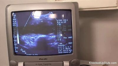 Knocked up Redhead Sucks and Fucks in the Doctors Office