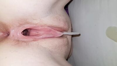 Қысылған және кең ашылған қынап