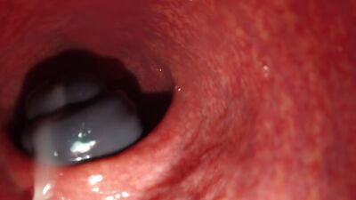 CÂMARA DENTRO DA VAGINA, GOZADA EM GRANDE PLANO (câmara escondida) Porno, sexo anal, incesto