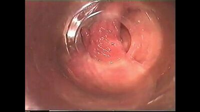 Masturbation from the Inside 1