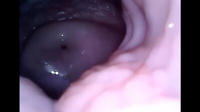 Kamera in der Vagina / Kamera in der Vagina von Frauen