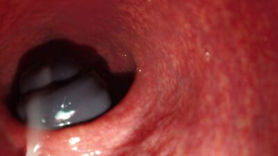 CÂMARA DENTRO DA VAGINA, GOZADA EM GRANDE PLANO (câmara escondida)Pornografia, sexo anal, incesto, broche, MILFs, lésbicas