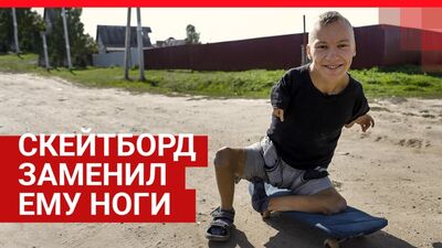 Cómo vive cerca de Ishim Serafim, un joven de 17 años sin brazos ni piernas