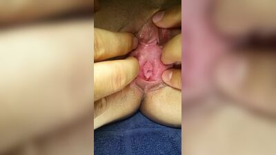 Exame minucioso da vagina de uma jovem
